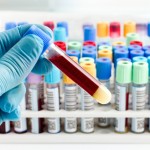 è‹±é£žå°¼è¿ªè”æ‰‹ä¸œè½¯è®¾2.5亿美元基金投资以色列医疗技术